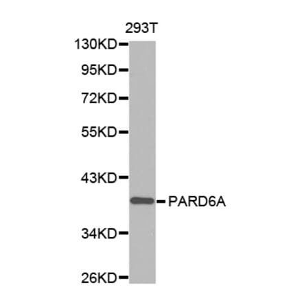 Anti-PARD6A Antibody from Bioworld Technology (BS7481) - Antibodies.com