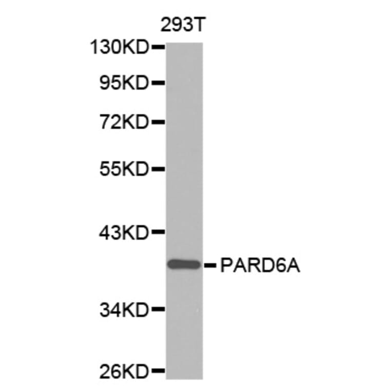 Anti-PARD6A Antibody from Bioworld Technology (BS7481) - Antibodies.com