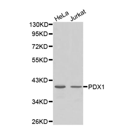 Anti-PDX1 Antibody from Bioworld Technology (BS7483) - Antibodies.com