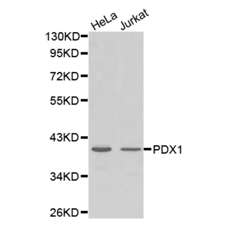 Anti-PDX1 Antibody from Bioworld Technology (BS7483) - Antibodies.com