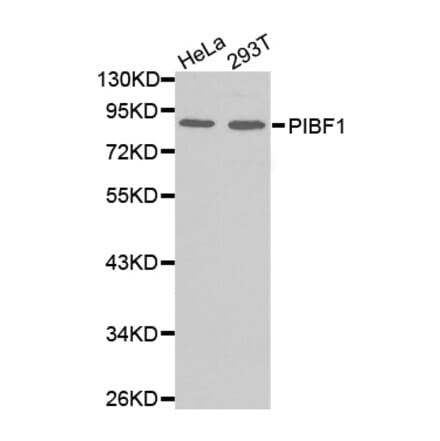 Anti-PIBF1 Antibody from Bioworld Technology (BS7484) - Antibodies.com