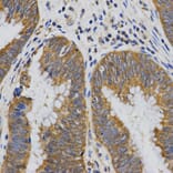 Anti-PIBF1 Antibody from Bioworld Technology (BS7484) - Antibodies.com