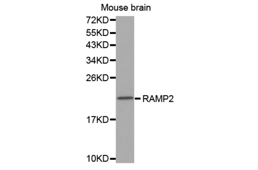 Anti-RAMP2 Antibody from Bioworld Technology (BS7486) - Antibodies.com