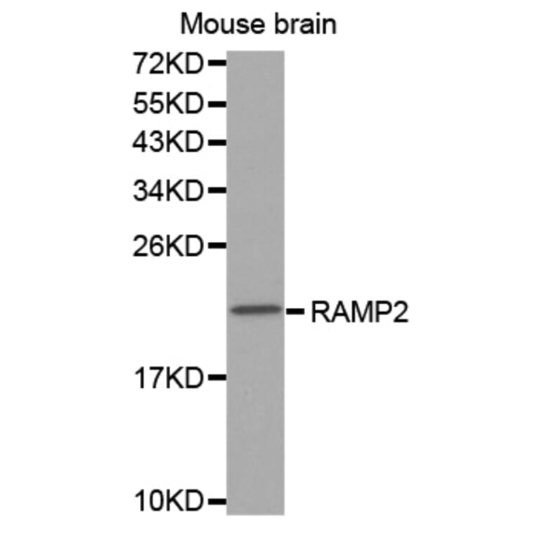 Anti-RAMP2 Antibody from Bioworld Technology (BS7486) - Antibodies.com
