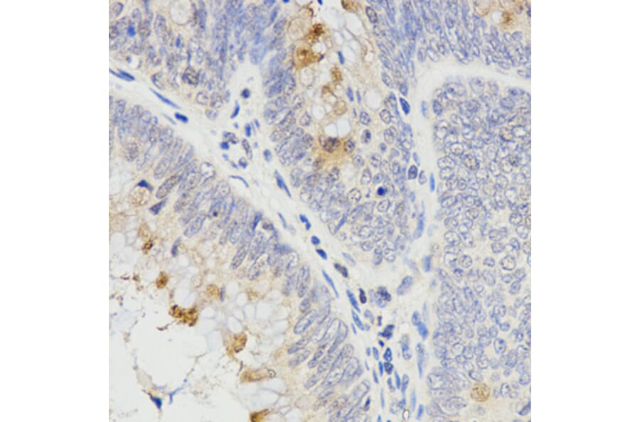 Anti-RAMP2 Antibody from Bioworld Technology (BS7486) - Antibodies.com