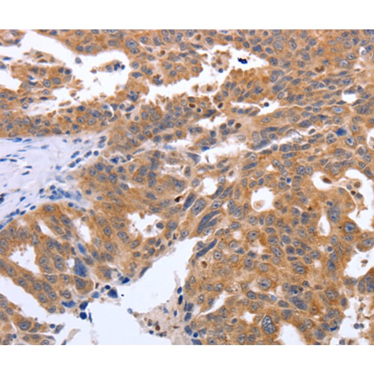 Anti-GEMIN2 Antibody from Bioworld Technology (BS7487) - Antibodies.com