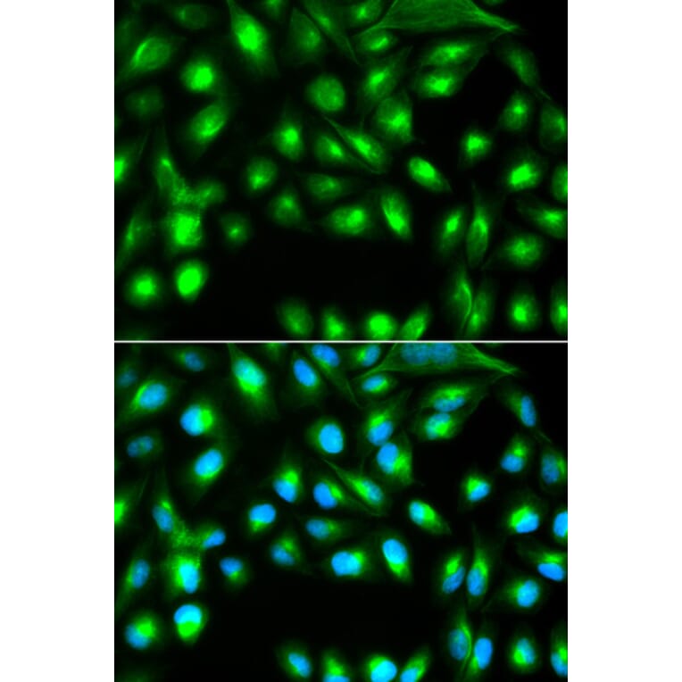 Anti-GEMIN2 Antibody from Bioworld Technology (BS7487) - Antibodies.com