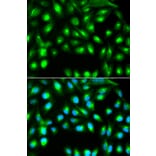 Anti-GEMIN2 Antibody from Bioworld Technology (BS7487) - Antibodies.com