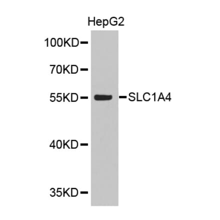 Anti-SLC1A4 Antibody from Bioworld Technology (BS7488) - Antibodies.com