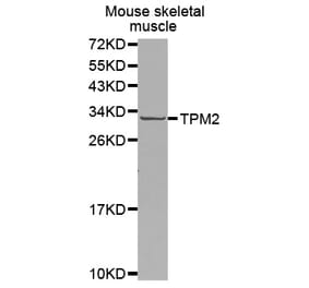 Anti-TPM2 Antibody from Bioworld Technology (BS7491) - Antibodies.com