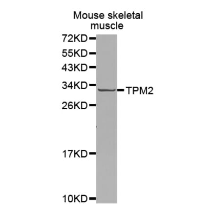 Anti-TPM2 Antibody from Bioworld Technology (BS7491) - Antibodies.com