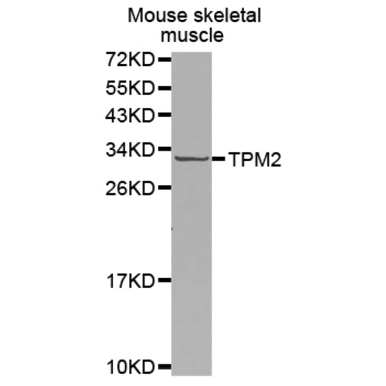 Anti-TPM2 Antibody from Bioworld Technology (BS7491) - Antibodies.com