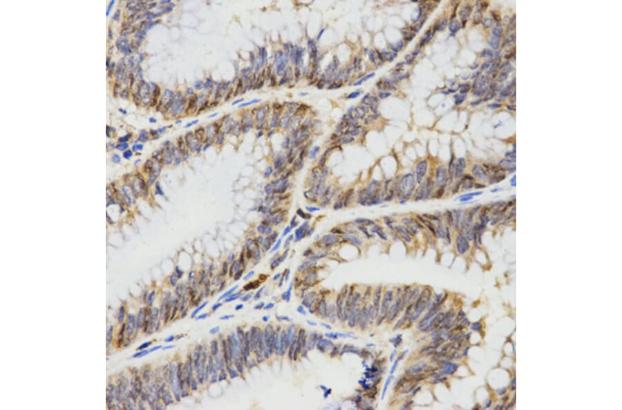 Anti-TPM2 Antibody from Bioworld Technology (BS7491) - Antibodies.com