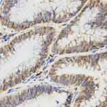 Anti-TPM2 Antibody from Bioworld Technology (BS7491) - Antibodies.com
