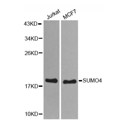Anti-SUMO4 Antibody from Bioworld Technology (BS7494) - Antibodies.com