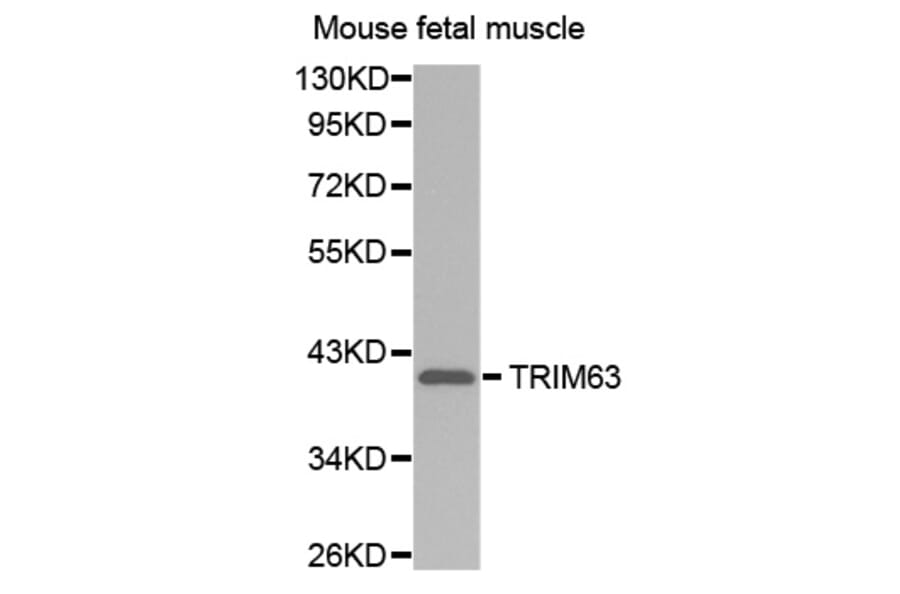 Anti-TRIM63 Antibody from Bioworld Technology (BS7495) - Antibodies.com
