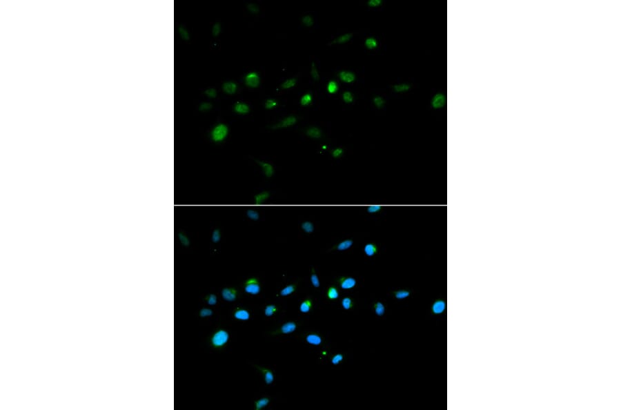 Anti-TRIM63 Antibody from Bioworld Technology (BS7495) - Antibodies.com