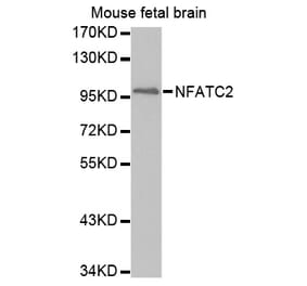 Anti-NFATC2 Antibody from Bioworld Technology (BS7497) - Antibodies.com