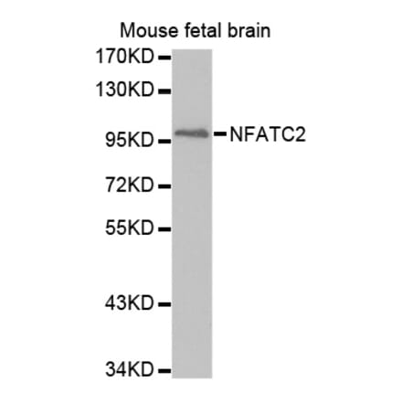 Anti-NFATC2 Antibody from Bioworld Technology (BS7497) - Antibodies.com