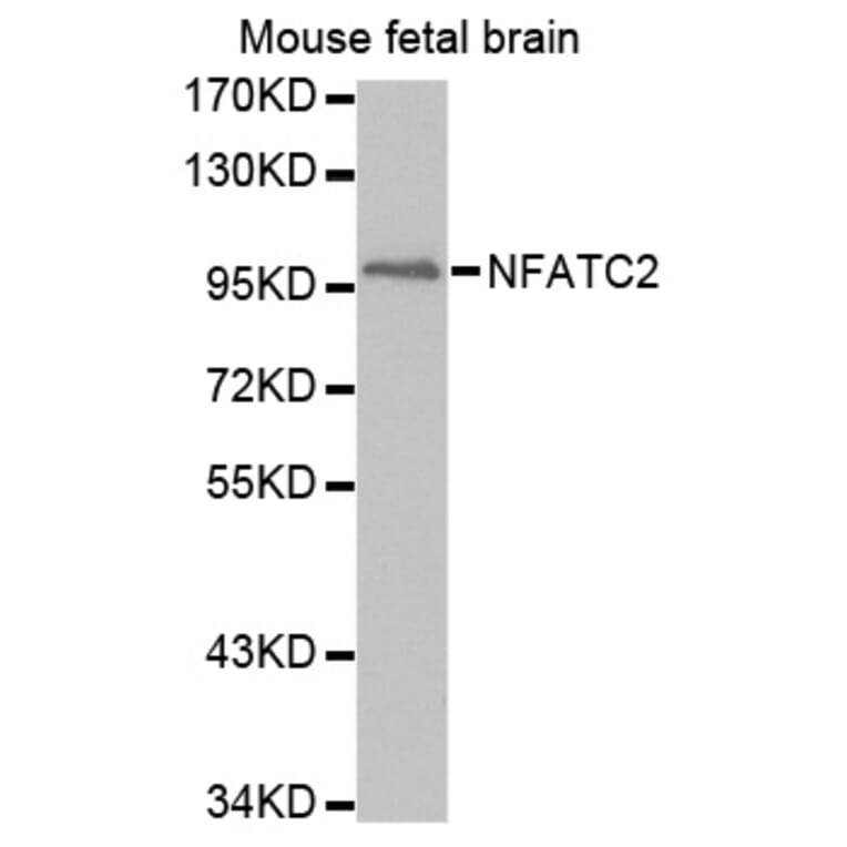 Anti-NFATC2 Antibody from Bioworld Technology (BS7497) - Antibodies.com