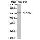 Anti-NFATC2 Antibody from Bioworld Technology (BS7497) - Antibodies.com