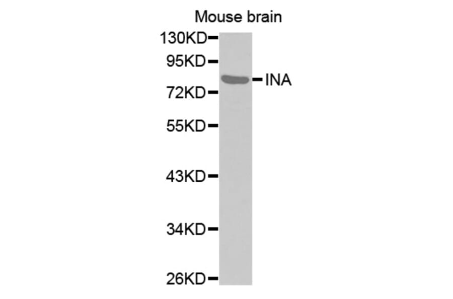Anti-INA Antibody from Bioworld Technology (BS7498) - Antibodies.com