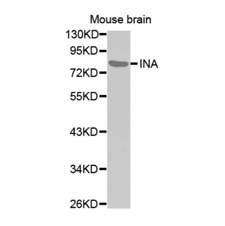 Anti-INA Antibody from Bioworld Technology (BS7498) - Antibodies.com