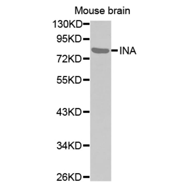 Anti-INA Antibody from Bioworld Technology (BS7498) - Antibodies.com
