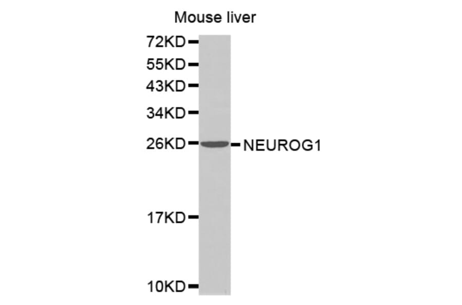 Anti-NEUROG1 Antibody from Bioworld Technology (BS7499) - Antibodies.com