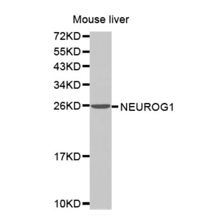 Anti-NEUROG1 Antibody from Bioworld Technology (BS7499) - Antibodies.com