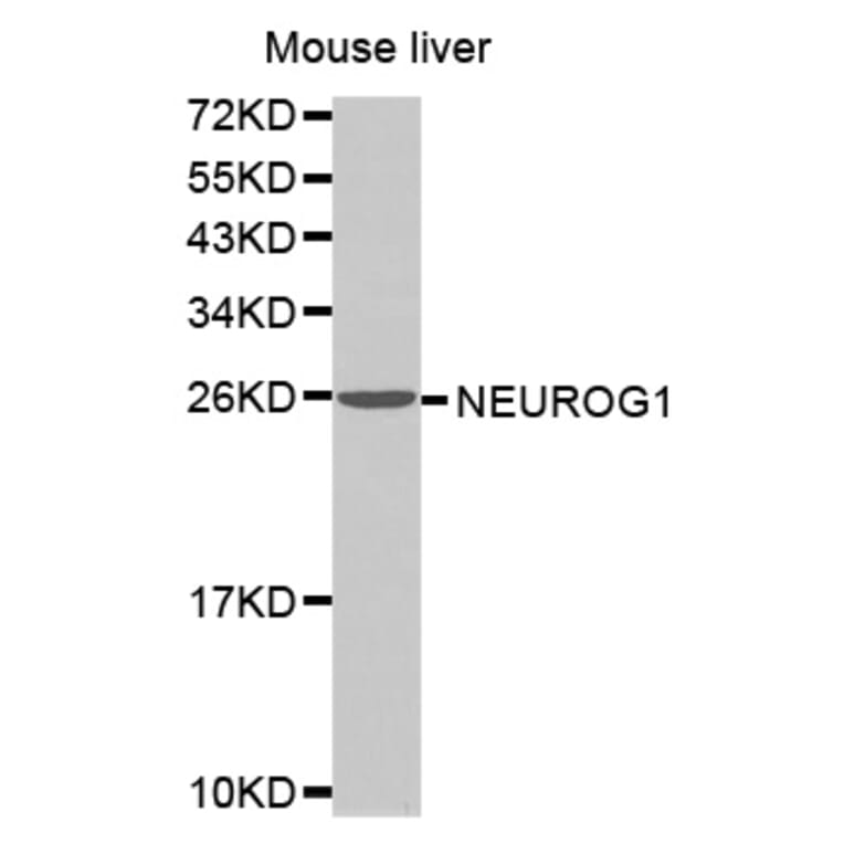 Anti-NEUROG1 Antibody from Bioworld Technology (BS7499) - Antibodies.com