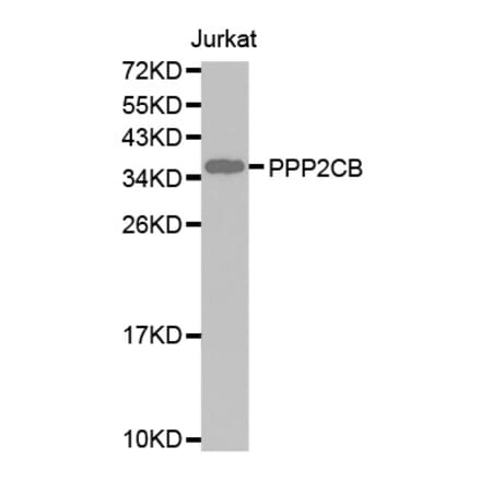 Anti-PPP2CB Antibody from Bioworld Technology (BS7503) - Antibodies.com