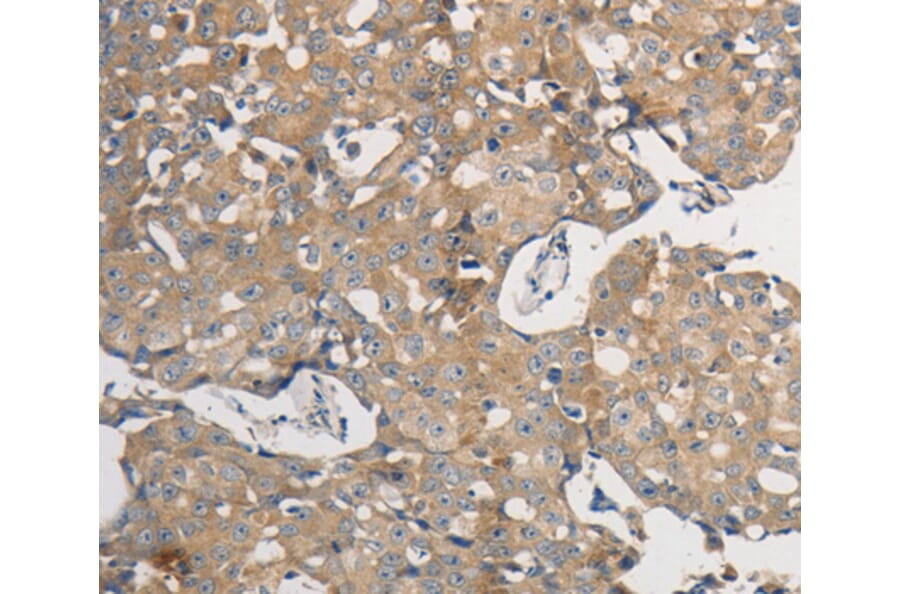 Anti-PPP2CB Antibody from Bioworld Technology (BS7503) - Antibodies.com