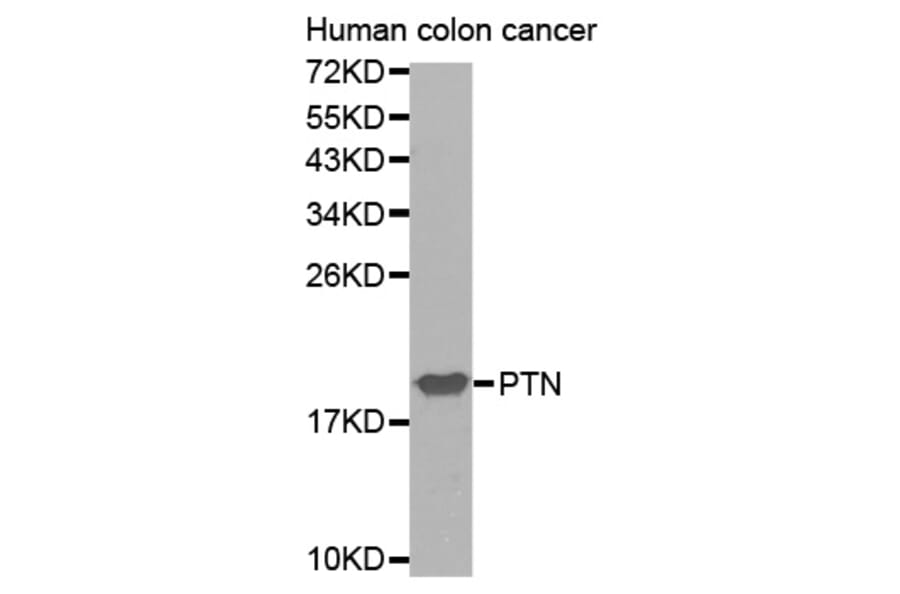 Anti-PTN Antibody from Bioworld Technology (BS7504) - Antibodies.com