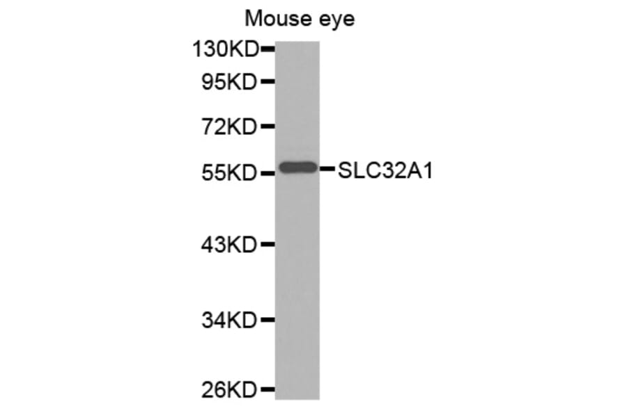 Anti-SLC32A1 Antibody from Bioworld Technology (BS7507) - Antibodies.com