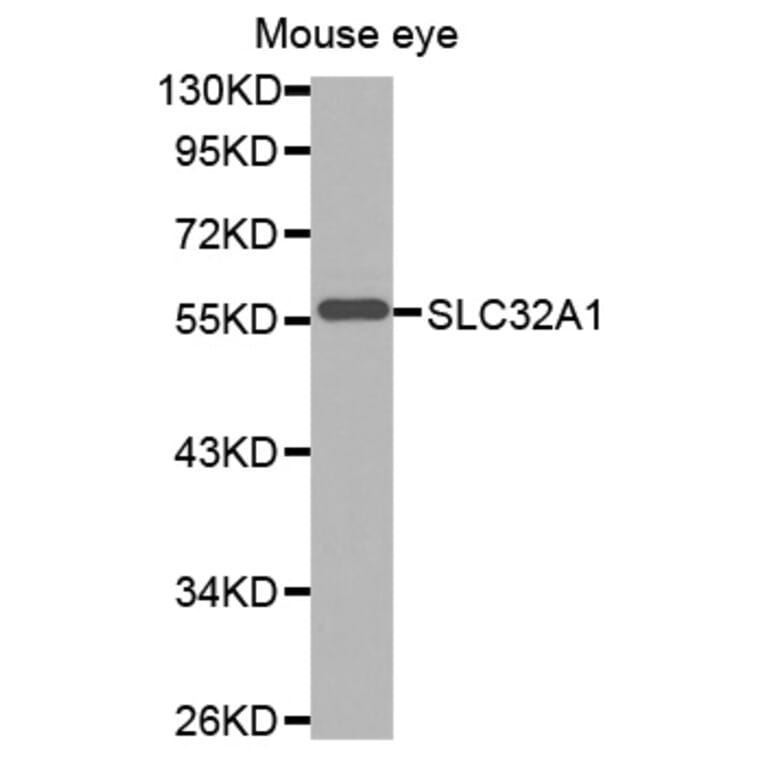 Anti-SLC32A1 Antibody from Bioworld Technology (BS7507) - Antibodies.com