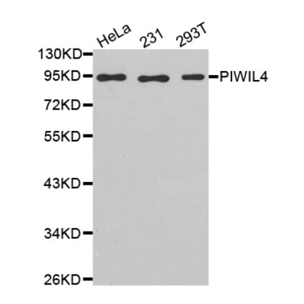 Anti-PIWIL4 Antibody from Bioworld Technology (BS7509) - Antibodies.com