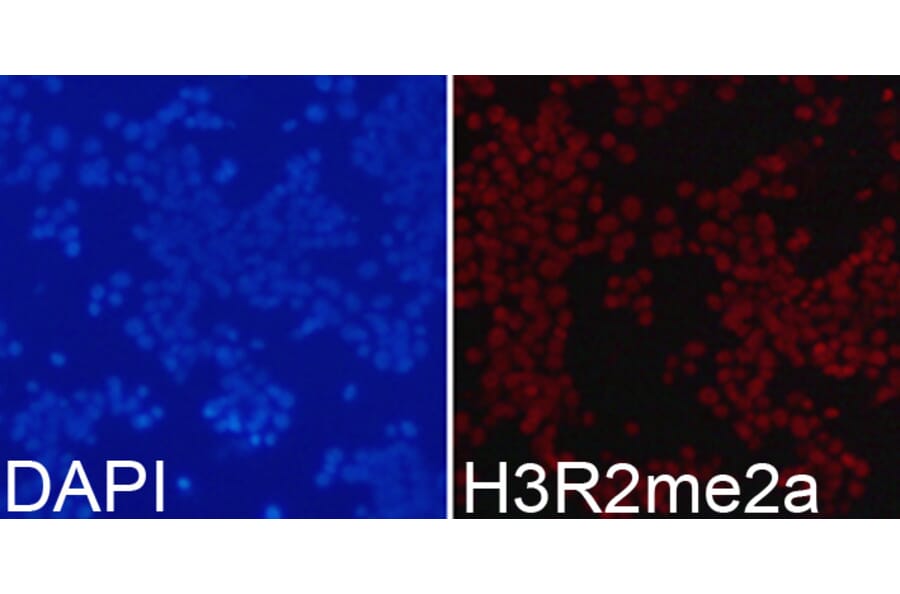 Anti-Histone H3 (aDi-Methyl R2) Antibody from Bioworld Technology (BS7511) - Antibodies.com