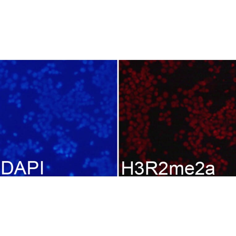 Anti-Histone H3 (aDi-Methyl R2) Antibody from Bioworld Technology (BS7511) - Antibodies.com