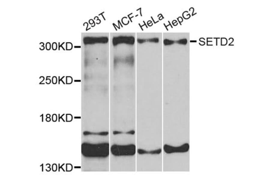 Anti-SETD2 Antibody from Bioworld Technology (BS7519) - Antibodies.com