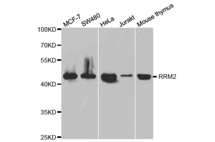 Anti-RRM2 Antibody from Bioworld Technology (BS7520) - Antibodies.com