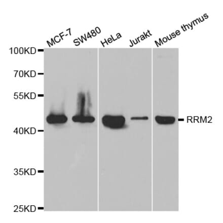 Anti-RRM2 Antibody from Bioworld Technology (BS7520) - Antibodies.com