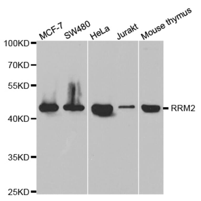Anti-RRM2 Antibody from Bioworld Technology (BS7520) - Antibodies.com