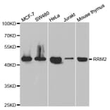 Anti-RRM2 Antibody from Bioworld Technology (BS7520) - Antibodies.com