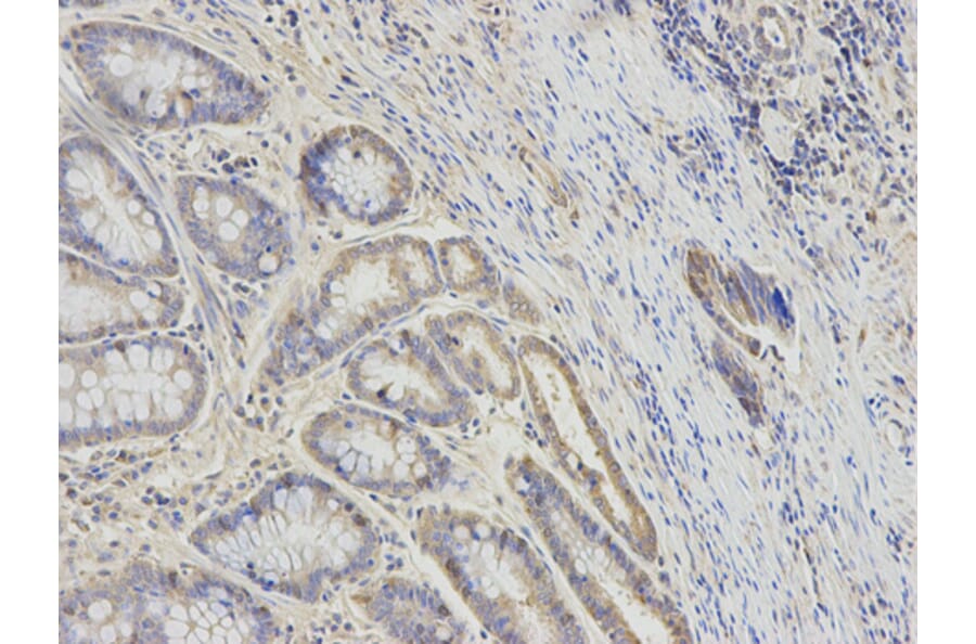 Anti-RRM2 Antibody from Bioworld Technology (BS7520) - Antibodies.com