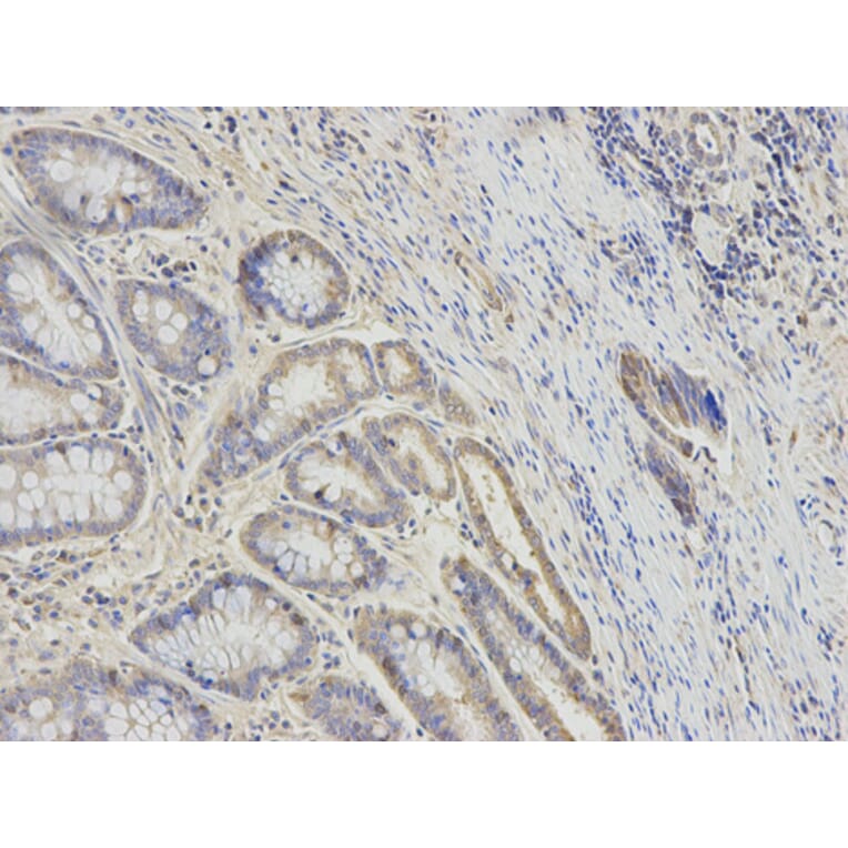 Anti-RRM2 Antibody from Bioworld Technology (BS7520) - Antibodies.com