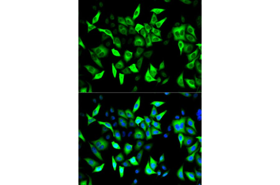 Anti-RRM2 Antibody from Bioworld Technology (BS7520) - Antibodies.com