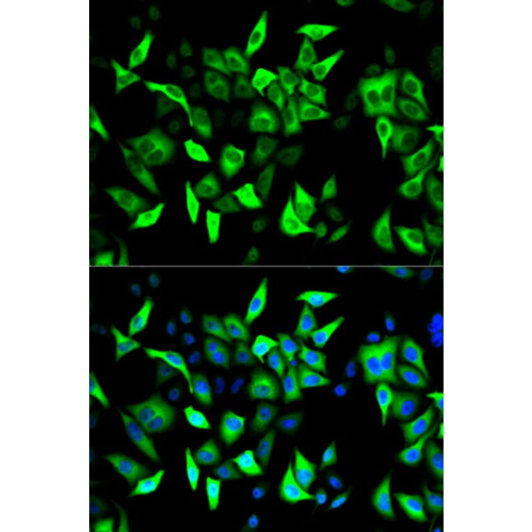 Anti-RRM2 Antibody from Bioworld Technology (BS7520) - Antibodies.com