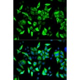 Anti-RRM2 Antibody from Bioworld Technology (BS7520) - Antibodies.com