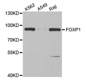 Anti-FOXP1 Antibody from Bioworld Technology (BS7522) - Antibodies.com